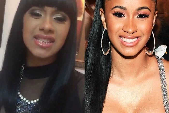 Cardi B Teeth Transformation