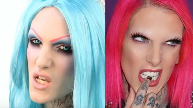 Jeffree-Star-Teeth-Before-After
