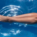 minimize cellulite.