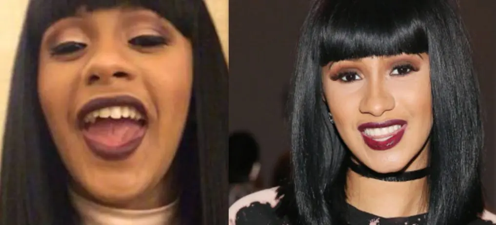 cardi-b-teeth.jpg