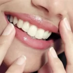 Tips For Restoring Your Smile