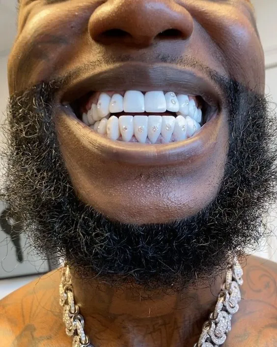 Gucci Mane grillz