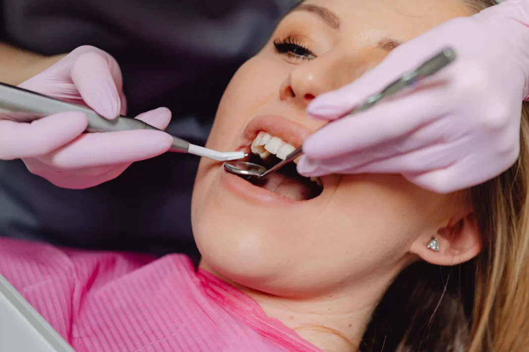 Cost of Dental Bonding