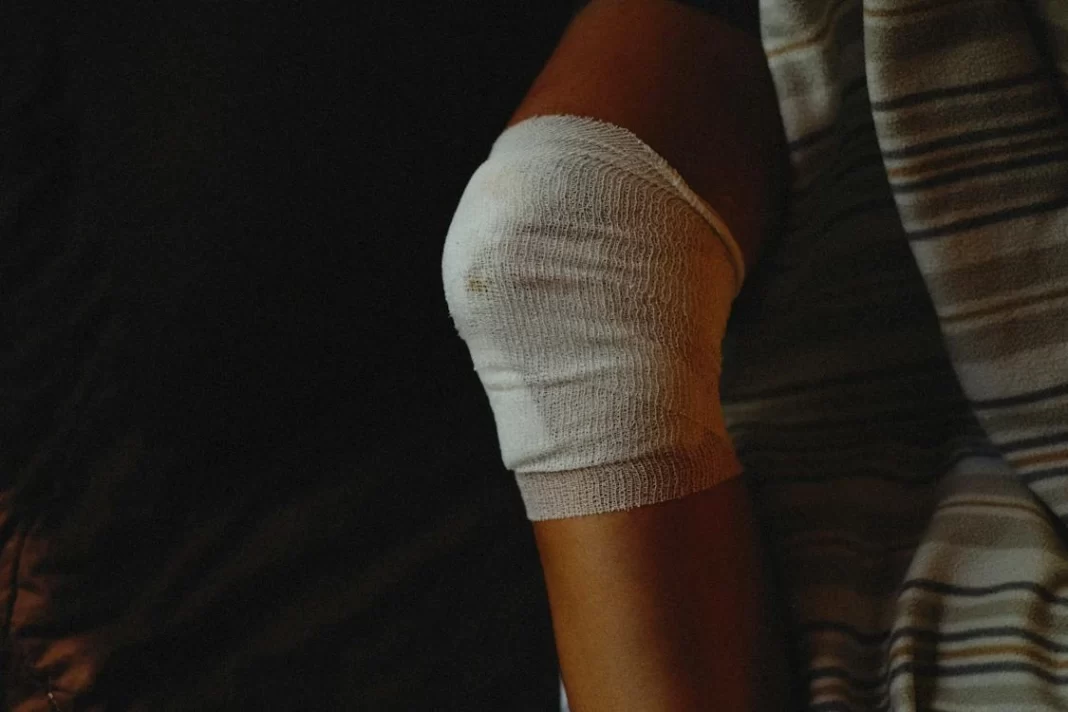 Role of Nutrition in Wound Healing