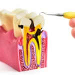 what is periodontics