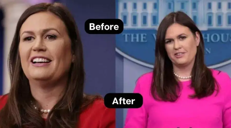 sarah huckabee sanders before after