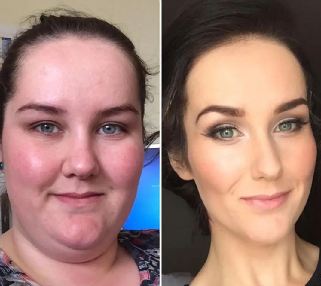 lose face fat